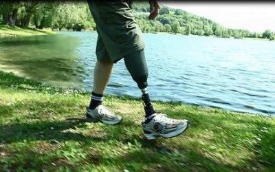 PROTESIS DE MIEMBRO INFERIOR CON REINERVACIÓN SENSORIAL